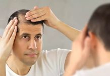 Hair Transplantation – An Effective Treatment For Hair Loss