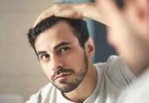 balding treatment and tips