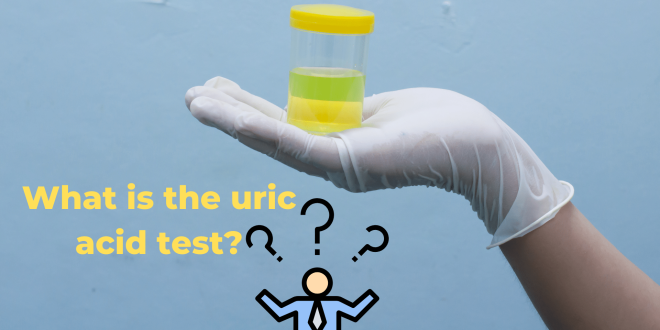 What is the uric acid test